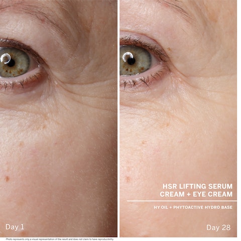 before and after using Babor HSR LIFTING Anti-Wrinkle Serum